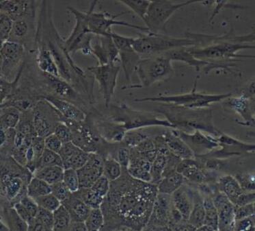 兔纤维环细胞,Fibroblasts Cells