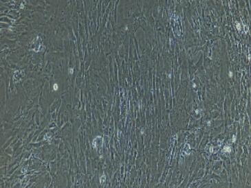 兔输卵管平滑肌细胞,Tubal Smooth Muscle Cells
