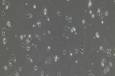 兔软骨细胞,Chondrocytes Cells