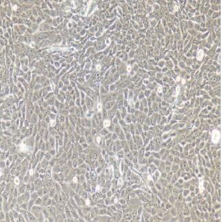 兔输尿管上皮细胞,Ureteral Epithelial Cells