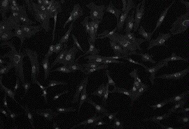 视网膜muller细胞,Retinal Muller Cells