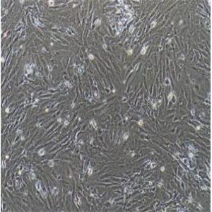 小鼠颈动脉成纤维细胞