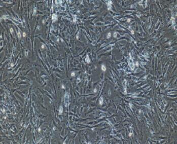 兔膀胱基质成纤维细胞,Bladder Matrix Fibroblasts Cells