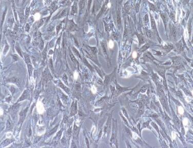兔膀胱平滑肌细胞,Bladder Smooth Muscle Cells
