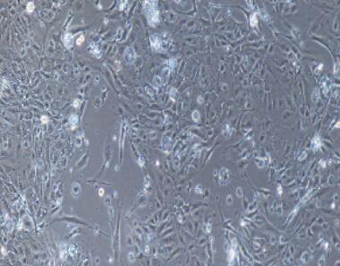 兔膀胱上皮细胞,Bladder Epithelial Cells