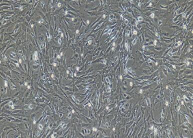 兔肾上腺皮质细胞,Adrenal Cortical Cells