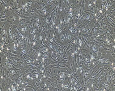 兔甲狀腺成纖維細(xì)胞,Thyroid Fibroblasts Cells