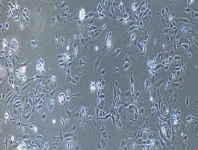 兔甲狀腺上皮細(xì)胞,Thyroid Epithelial Cells