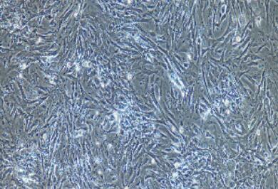 兔骨骼肌成纤维细胞,Skeletal Muscle Fibroblasts Cells