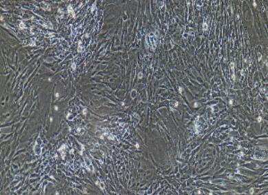 兔髓核细胞,Nucleus Pulposus Cells