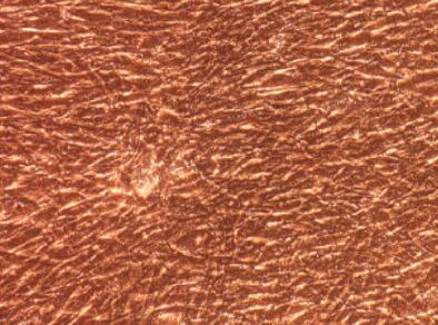 兔淋巴管成纤维细胞,Lymphatic Fibroblasts Cells