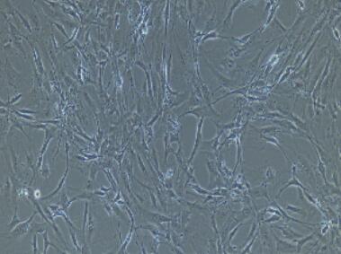 兔胞腦動(dòng)脈血管內(nèi)皮細(xì)胞,Cerebral Arterial Endothelial Cells