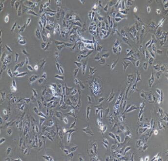 兔晶狀體上皮細胞,Lens Epithelial Cells