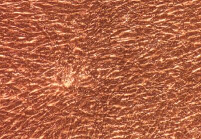 兔脉络膜成纤维细胞,Choroidal Fibroblasts Cells