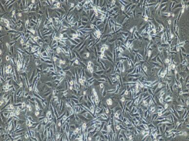 兔视网膜微血管内皮细胞,Retinal Microvascular Endothelial Cells