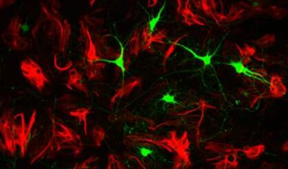 兔三叉神经星形胶质细胞