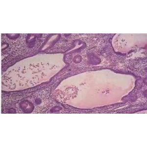 猪子宫内膜基质细胞