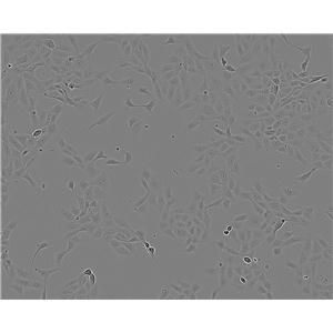 Hs 683 Cells|人脑胶质瘤细胞系,Hs 683 Cells