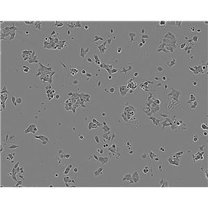 Capan-1 Cells|人胰腺癌細胞系,Capan-1 Cells