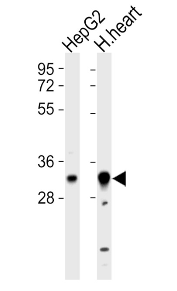 Anti-HCCS antibody produced in rabbit,Anti-HCCS antibody produced in rabbit