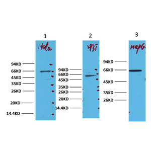 ANTI-NF-KB P65抗体,Anti-NF-kB p65 Antibody