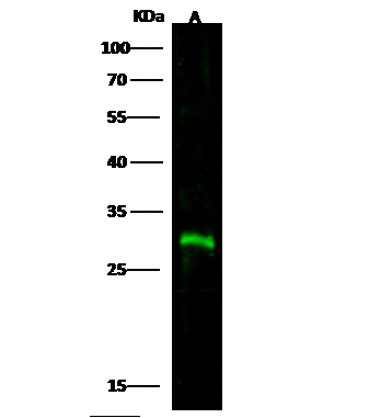 ANTI-CTLA4抗體,Anti-CTLA4 antibody