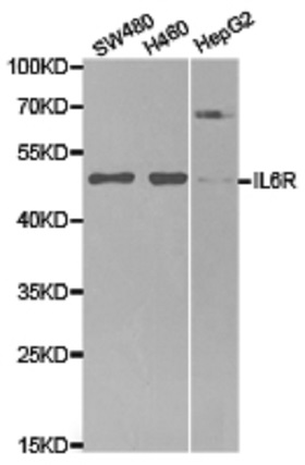 兔抗IL6R多克隆抗體,Anti-IL6R rabbit polyclonal antibody