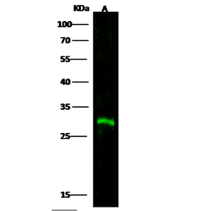 ANTI-CTLA4抗体