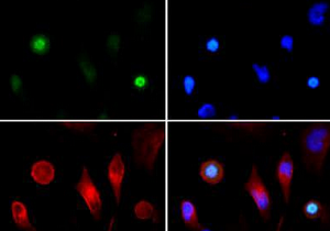 ANTI-HISTONE H3 (PHOSPHO T3,ACETYL K4)抗體,Anti-Histone H3 (phospho T3, acetyl K4) antibody