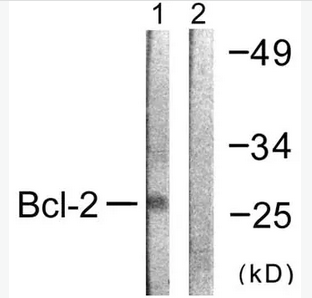 ANTI-BCL-2抗体,Anti-BCL2 antibody