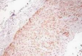 辣根过氧化物酶标记 肿瘤坏死因子抗体,Rabbit anti-TNF-α /HRP