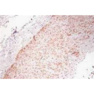 辣根过氧化物酶标记 肿瘤坏死因子抗体,Rabbit anti-TNF-α /HRP