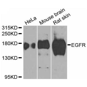 Anti-EGFR Antibody,Anti-EGFR Antibody