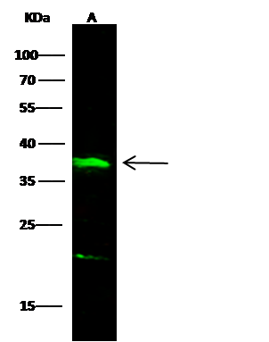 ANTI-IL-12 P70抗体,Anti-IL-12 p70 antibody