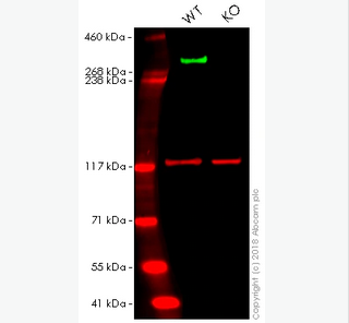 ANTI-NESTIN抗体,Anti-Nestin Antibody