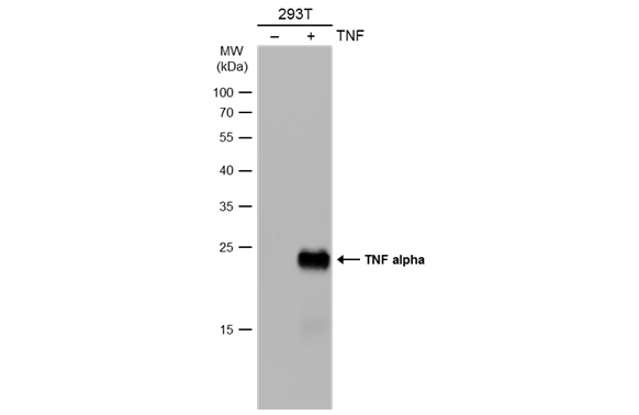 生物素标记 肿瘤坏死因子抗体,Rabbit anti-TNF-α /Biotin