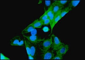 小鼠抗β-Tubulin单克隆抗体,Mouse Anti-beta tubulin Monoclonal Tag Antibody
