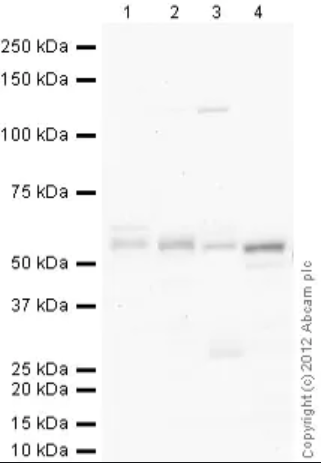 ANTI-PARKIN抗体,Anti-Parkin Antibody