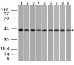 BETA ACTIN抗体,beta Actin antibody