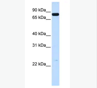 ANTI-HUMAN HGF