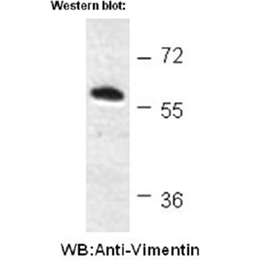 抗波形蛋白小鼠单克隆抗体,Anti-Vimentin Mouse mAb