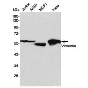 抗波形蛋白小鼠单克隆抗体