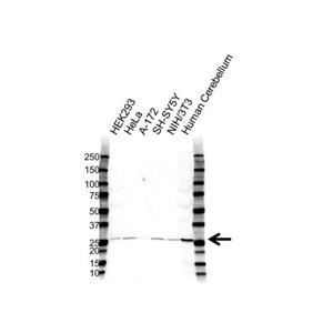 Anti-BDNF Polyclonal Antibody,Anti-BDNF Polyclonal Antibody