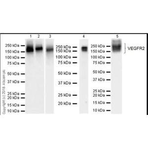 ANTI-VEGF抗体,Anti-VEGF Antibody