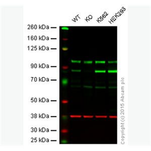 兔抗PKC ALPHA多克隆抗体,Rabbit anti-PKC alpha Polyclonal Antibody