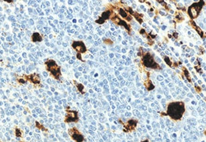 CD68抗体(用于大鼠、小鼠),CD68 Rabbit Polyclonal Antibody