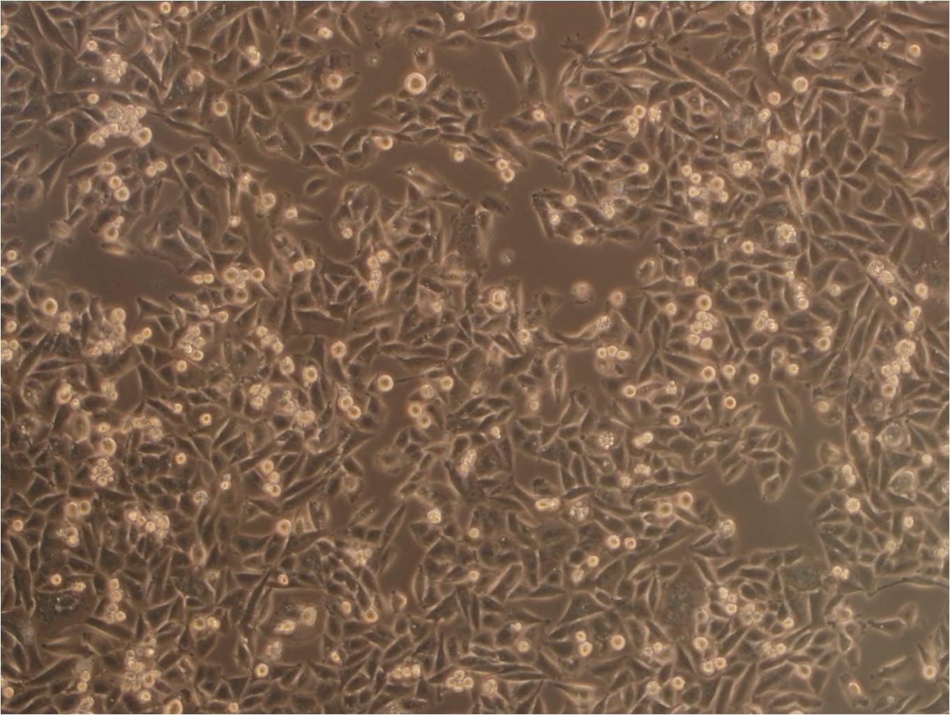 UMR-106 Cells|大鼠骨肉瘤细胞系,UMR-106 Cells