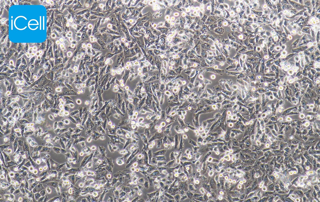 NCI-H1703 人肺鳞癌细胞,NCI-H1703
