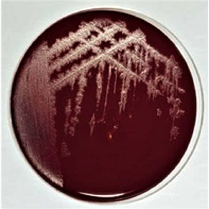 破伤风梭菌培养基基础,Clostridium Temtani Medium