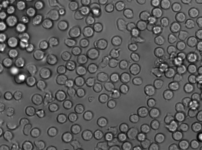 ARH-77 Cell|人浆细胞白血病细胞,ARH-77 Cell